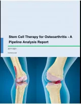Stem Cell Therapy for Osteoarthritis - A Pipeline Analysis Report